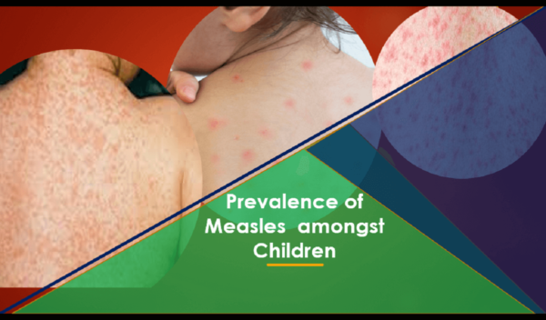 measles among children